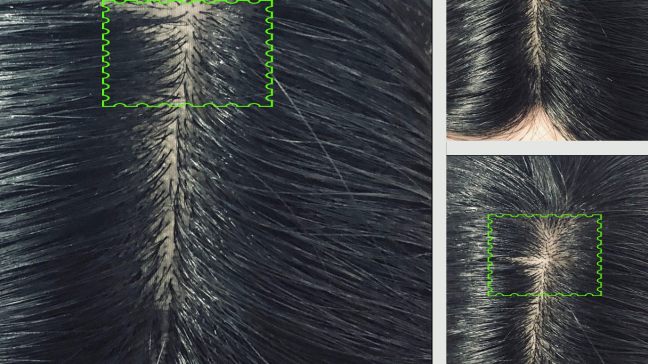 Your Hair Parting Might Be The Cause Of Your Hair Breaking