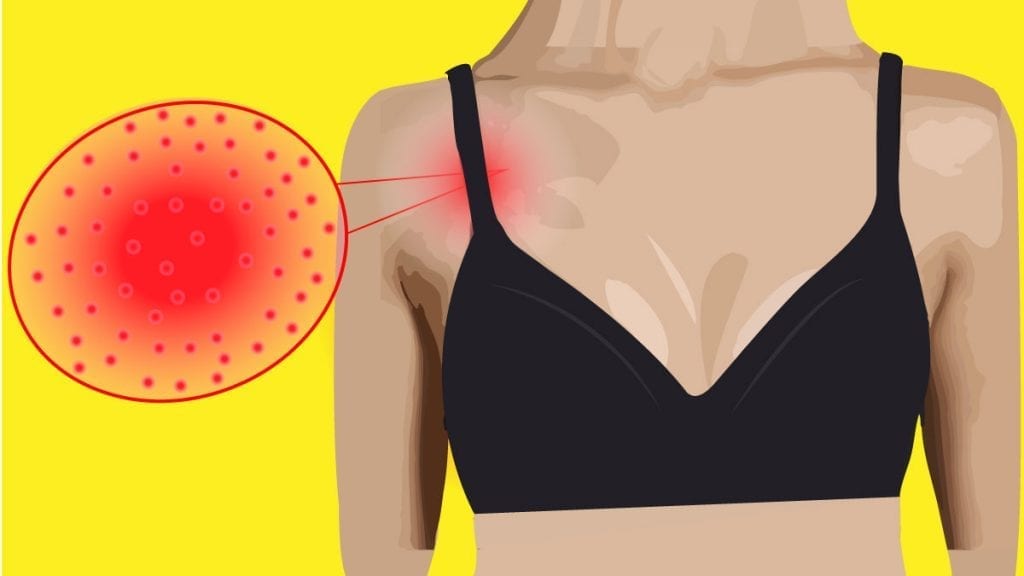 Bra Causes Of Rashes