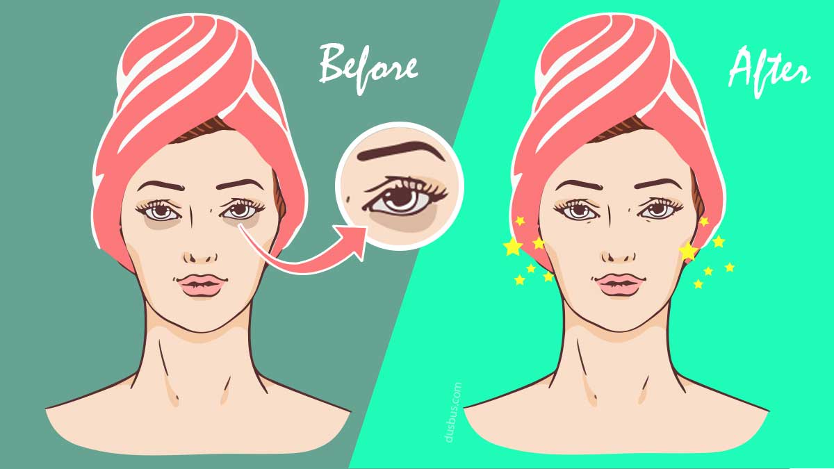 Remove Dark Circles Before And After