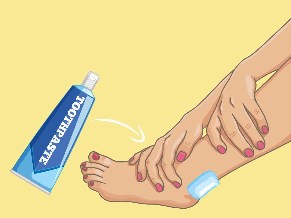 Homeremedy for shoe bit apply toothpaste on shoe bite