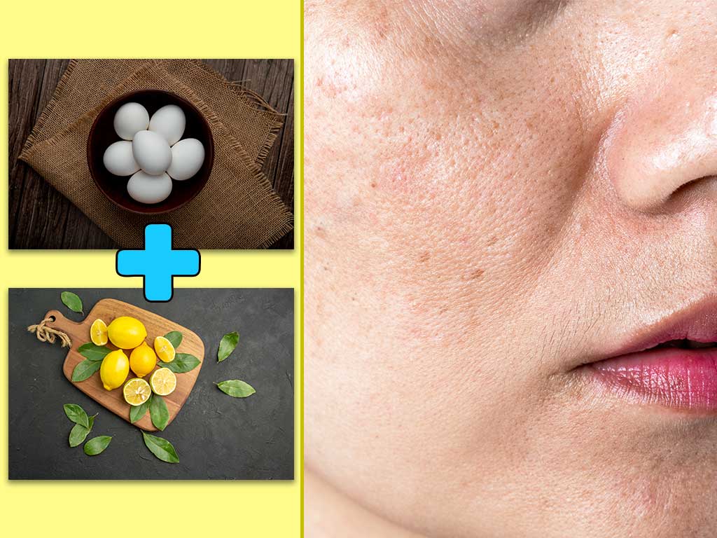 egg lemon face pack