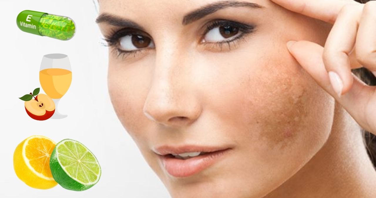 how to remove pigmentation from face