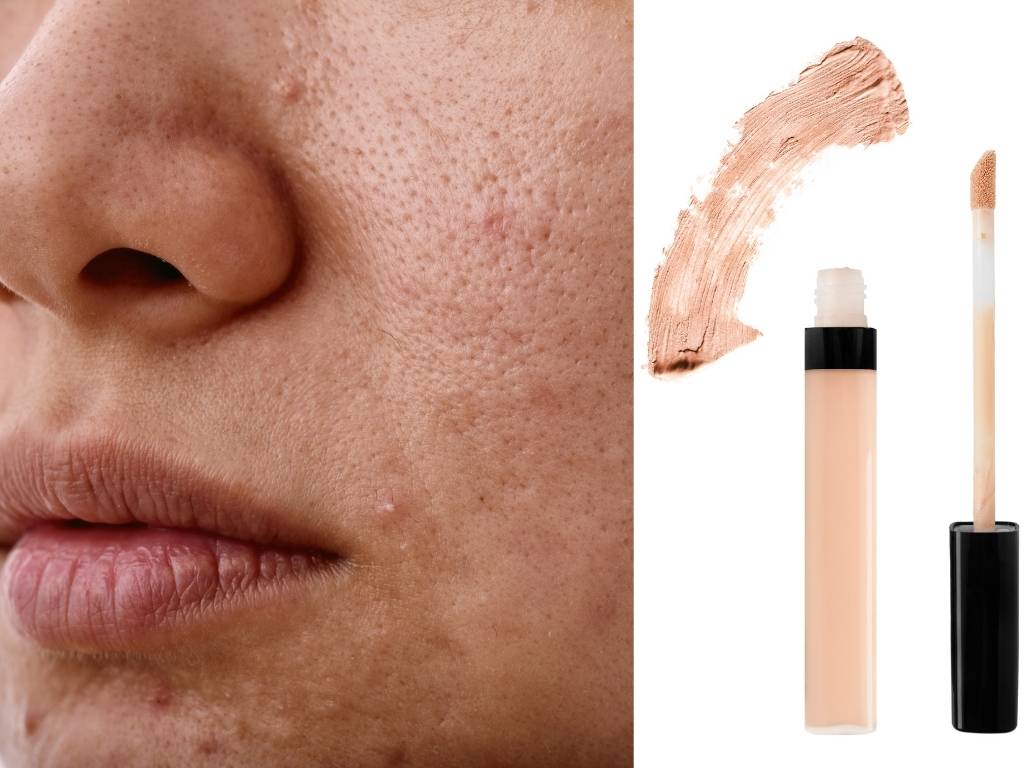 Pimple On Skin, Dark Concealer