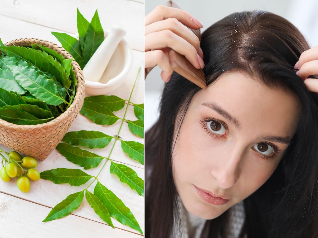 neem leaf dandruff hair