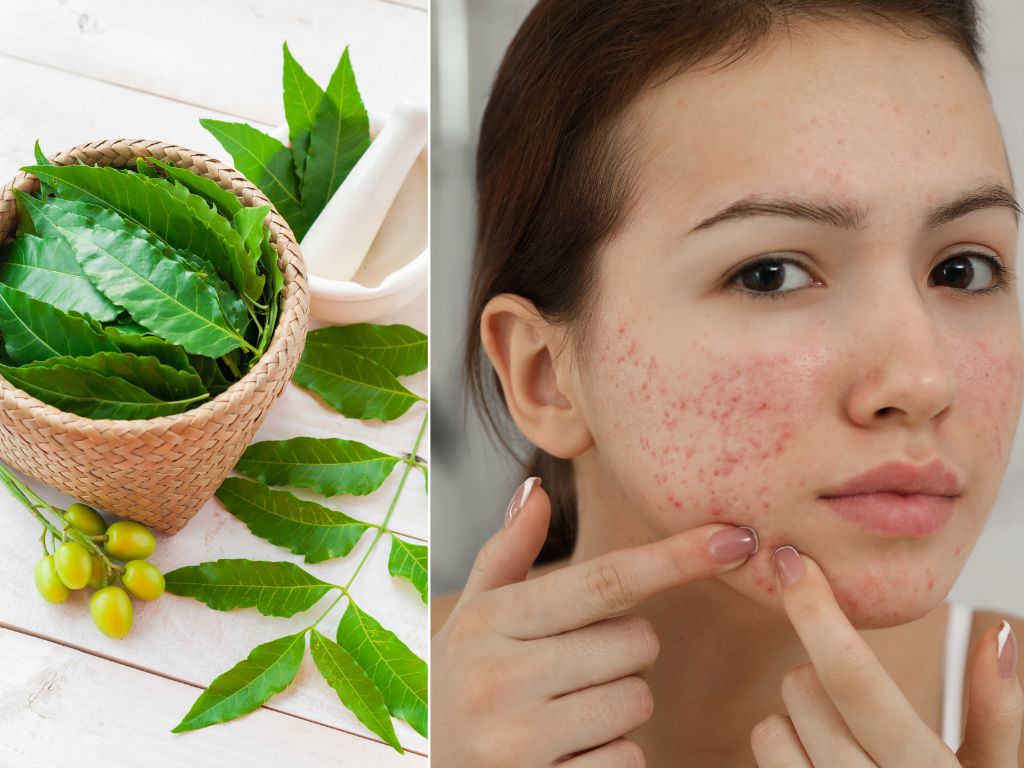 neem use for pimple
